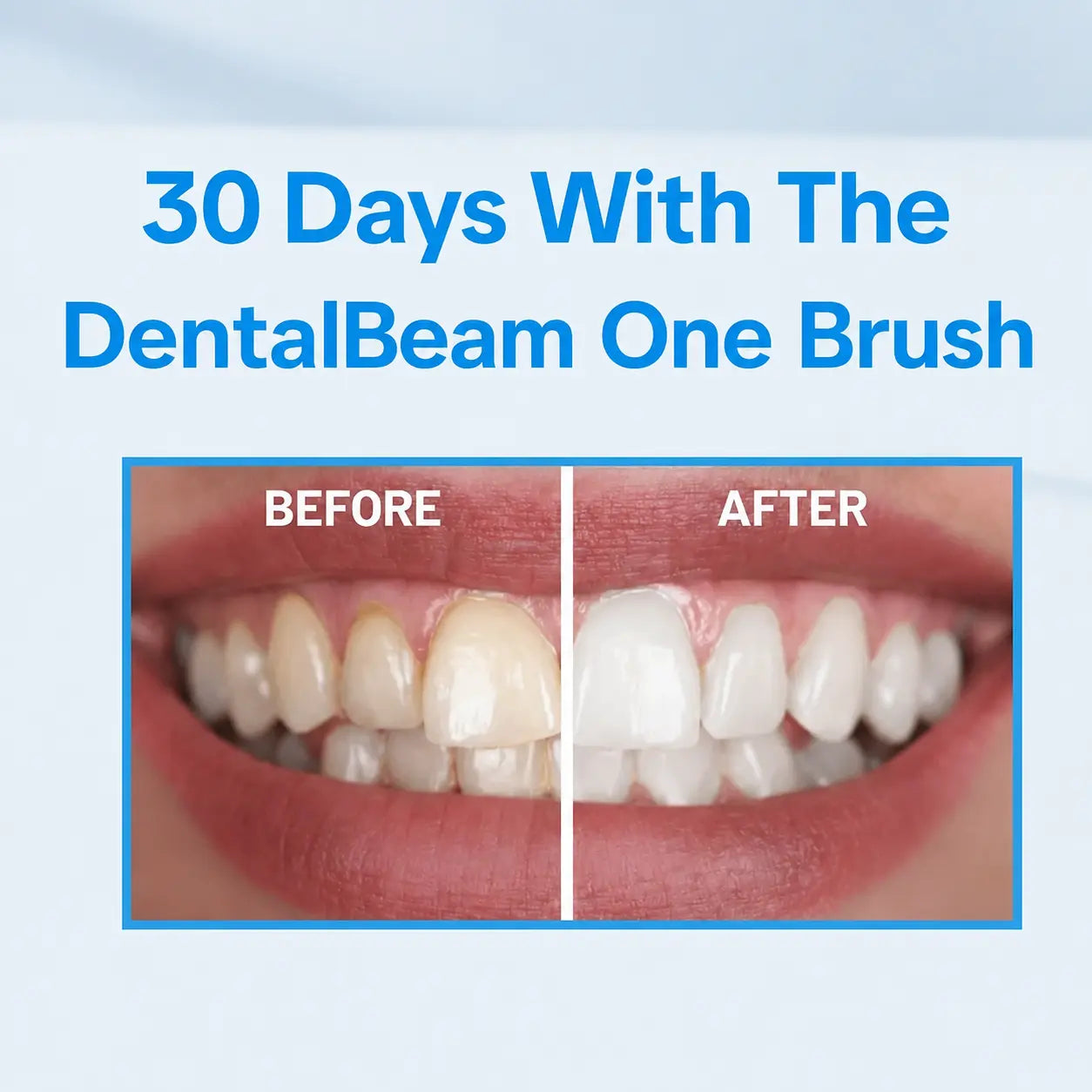 DentalBeam One