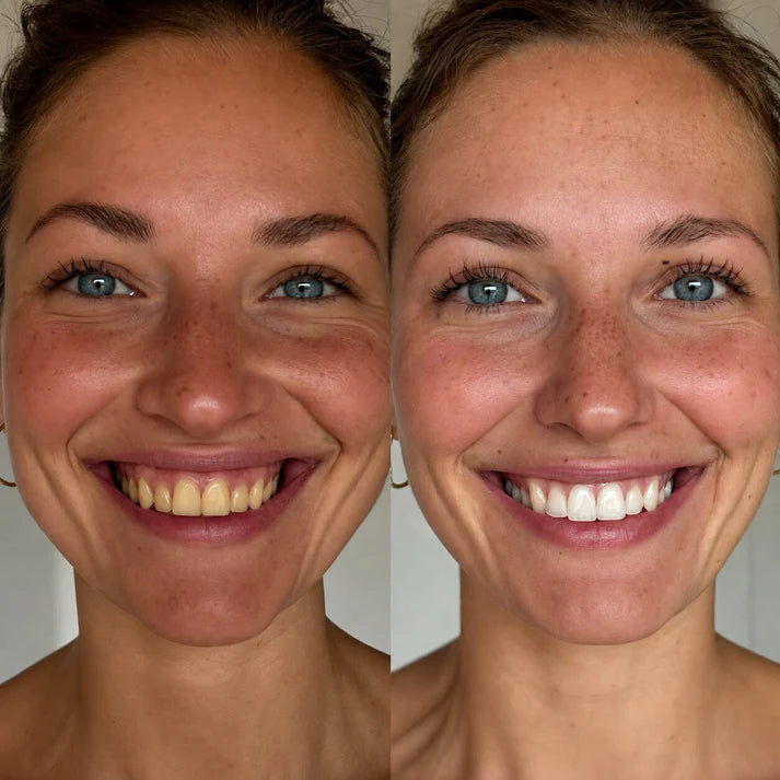 DentalBeam One