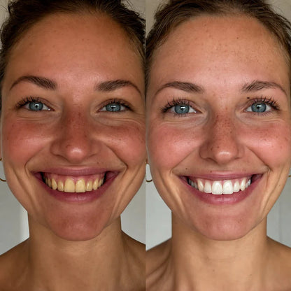 DentalBeam One